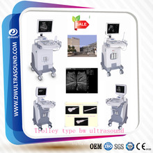 DW370 ultrasound scan machine price & ultrasound machine for pregnancy